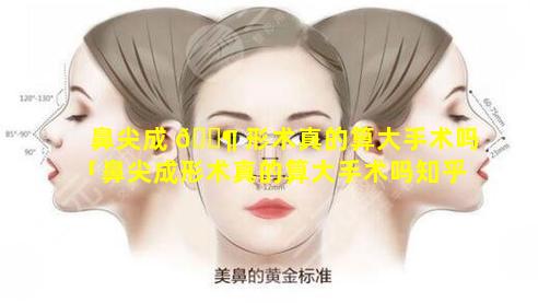 鼻尖成 🐶 形术真的算大手术吗「鼻尖成形术真的算大手术吗知乎」